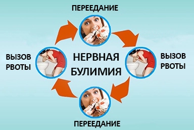 Лечение булимии в Красноуфимске